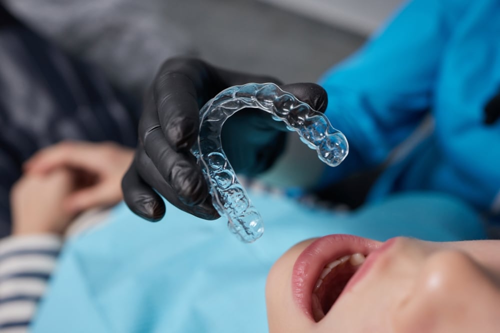 clear aligner